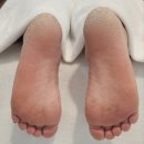 뷰티 에스떼땅 | 광교 네일 발각질관리 안전하게 케어받고 매끈해졌어요~