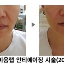 The 예쁜 피부