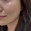 두산사우나 | 수성구 스킨플래닝 전문 뽐온뷰티 두산점 인생 첫 스킨플래닝 후기