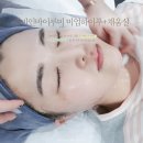 압량 피부관리 렛미인뷰티 리프팅 대박이네