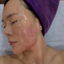 성모약국 | [노은동 피부관리샵] 브이라인 리프팅, 모공관리 추천 | 성모피부관리실 | 솔직 후기