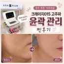 신용고주파 | 양주 뷰티 l 옥정_"아라리움" l 이중턱 고민으로 통증없이 고주파 윤곽관리 받은 후기