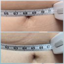 라인에너지 | 청라다이어트 복부비만관리는 리바디라인 에너지테라피 받은 후기