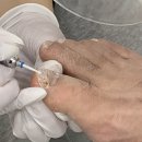 부산발톱무좀 레푸스 부산 대연점에서 관리받은 후기