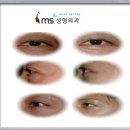 엠에스(MS)성형외과의원 이미지