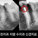 지행수치과 네이버블로그