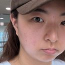 써니 | 부평피부과 써니리프팅 내돈내산 후기