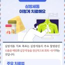 가슴이 두근거리고 답답하네 뇌졸증 일으키는 심방세동 이미지