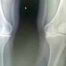 라파의료기 이미지