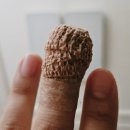 [일산 후곡]하얀나라 김피부과