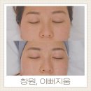 가양로 | 창원 피부관리 웨딩관리 대방동 이뻐지움 에스테틱 미백관리 1회 솔직후기