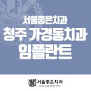 맑고밝음교정치과기공소 | 청주가경동치과 임플란트 수면치료가 가능한곳에서