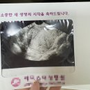 노산 계류유산 | 소파술 후 첫생리하고 바로 임신 |늦은착상 작은아기집 (절망편)-1부