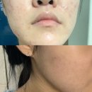 메디포엘 이미지