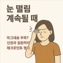 체크포인트