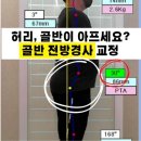&#34;[대구 PT 추천] 1:1 퍼스널 트레이닝 효과 - 다이어트 &amp; 체형교정 후기&#34;