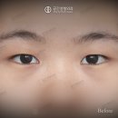 케이스성형외과