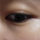 라인1차 | 아이라인 문신제거 1차 후기_문신 지우는 영수쌤