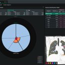 코어소프트 이미지