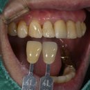 어울림 치과기공소 이미지