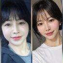 일진팩 | 전주 울쎄라 쥬베룩 스킨보톡스 내돈내산 솔직 후기