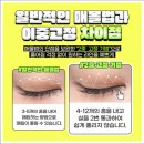 큰사랑외과의원 | 쌍수 잘하는 성형외과 찾고 있나요? 쌍수 매몰 가격과 후기 공유드려요