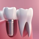 하양탑치과 이미지