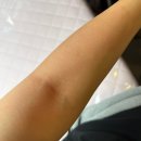 세븐일레븐인천간석나무점 | 간석동왁싱 간석동테라피 간석오거리왁싱 왁싱백프로 테라피 웨딩드레스 팔 전체 손등 손가락 털 왁싱 후기