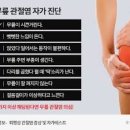 무릎 통증 완화 원한다면 근원 파악이 우선 이미지