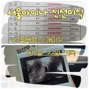 배양 | 서울아이나여성의원 난임 3일배양 신선이식 후기, 이식 12일차~22일차 증상&amp;테스트기