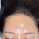 현헤어라인 이미지