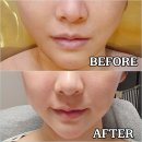 비움과 채움 | 행신동피부샵 비움과채움 물방울초음파 후기