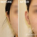 르에이치의원 이미지