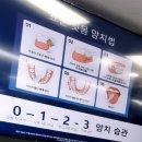 유니덴탈코리아 네이버블로그