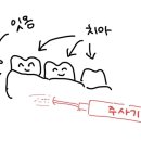 수성사랑니치과의원 이미지
