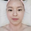 옥서5길(옥동) | 안동 옥동 피부샵 후기|비타민C케어부터 리프팅 까지 완벽 관리는 :: 미앤미::