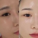 미더베스트