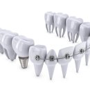 미소를만드는치과의원 이미지