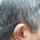 독일보청기 난청센터 | 시그니아독일보청기 도봉센터에서 돌발성난청 도움받았어요:)