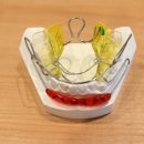 바른이디자인치과교정과 이미지