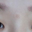 중앙 메디케어 이미지