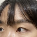 루즈에스테틱 이미지
