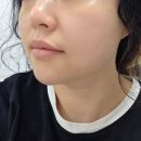드림에스테틱 부천원종점 | 부천 원종동 에스테틱 ‘이쁨’ 고주파 관리 받고 마음까지 케어받고 온 후기