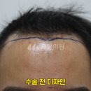 모엠의원 Daum카페