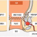 치질 원인과 종류 증상 치루, 치핵, 치열의 차이점 예방 방법 이미지