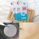 씨제이올리브영(주)플러스점 | 올리브영 1위 케어플러스 트러블 흔적 패치 꾸준히 흔적 케어 해본 후기