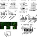 Re:Re:Hyperhomocysteinemia causes ER stress and impaired autophagy that is reversed by Vitamin B supplementation - 2016 네이처 논문 이미지