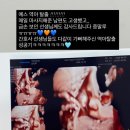 제이디_V | [35주, 36주] 막달검사, 역아 탈출 성공!!