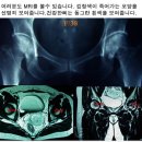 [고관절인공관절] 인공고관절 치환술에 대해 알아보자 이미지