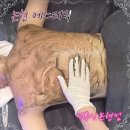 에스텍 | 에스테틱 추천 : 더록시에스테틱논현 / 논현 에스테틱샵 추천 / 등드름케어에는 더록시 에스텍